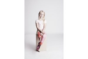 Zebedee Management: Limb Difference Awareness